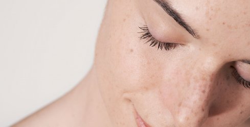 Pielea sensibilă poate fi pielea reactivă care tinde să se înroșească foarte ușor.