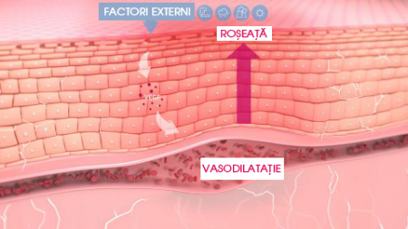 structura pielii cu roșeață