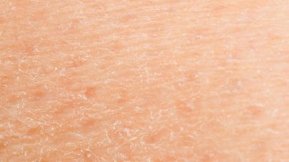 Cum Poți Diferenția Pielea Uscată De Cea Deshidrată Bioderma