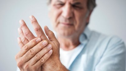 Allergic skin and damaged hands
