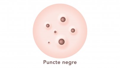 Puncte negre