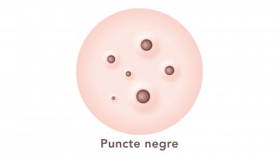 Puncte negre