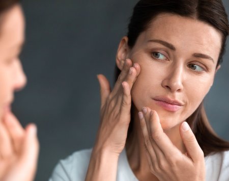 sebium_maskne-women-checking-acne-mirror