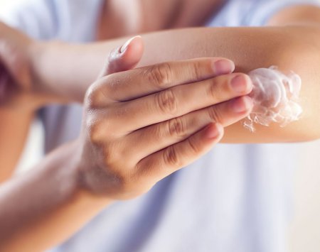Cum tratezi dermatita atopică? Emolientul pentru dermatita atopică la adulți
